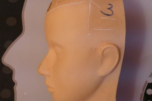 Мезотерапия кожи головы – отзывы, фракционная, волосистой части